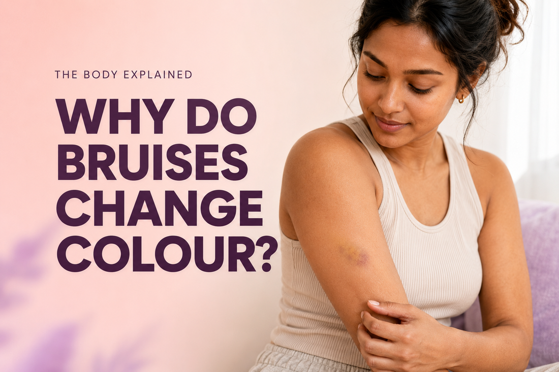 Person looking at a healing purple and yellow bruise on their upper arm