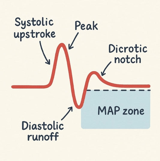 Arterial Line Waveform Explained for UK Student Nurses: Real-Time Blood Pressure Made Simple